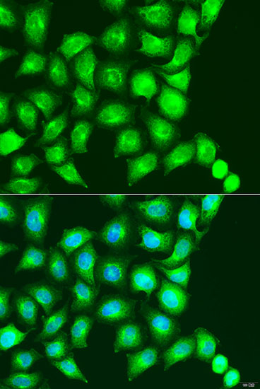 Immunofluorescence - UBIAD1 Polyclonal Antibody 