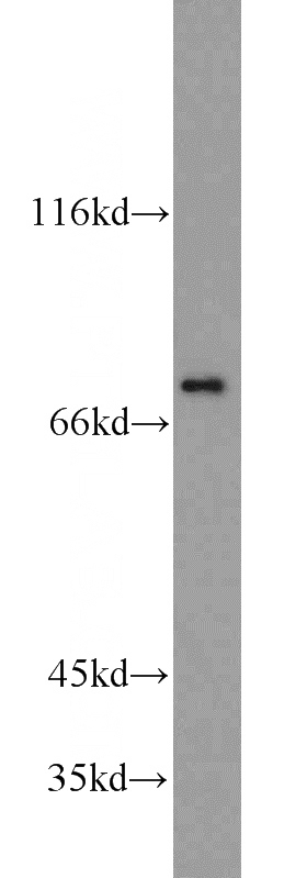 Jurkat cells were subjected to SDS PAGE followed by western blot with Catalog No:110621(FERMT3 antibody) at dilution of 1:300
