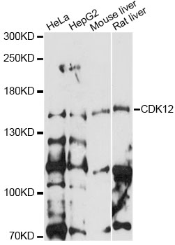 Western blot - CDK12 Polyclonal Antibody 
