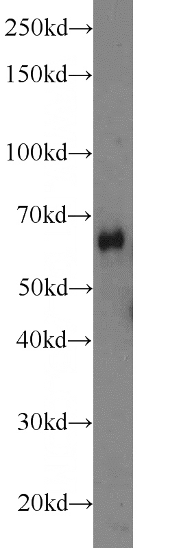HEK-293 cells were subjected to SDS PAGE followed by western blot with Catalog No:113326(ODF2L antibody) at dilution of 1:600