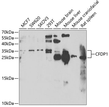 Western blot - CFDP1 Polyclonal Antibody 
