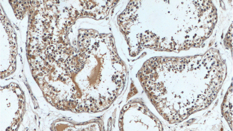 Immunohistochemistry of paraffin-embedded human testis tissue slide using Catalog No:114944(RXFP4 Antibody) at dilution of 1:200 (under 10x lens).