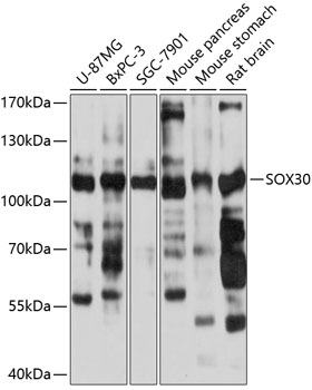 Western blot - SOX30 Polyclonal Antibody 