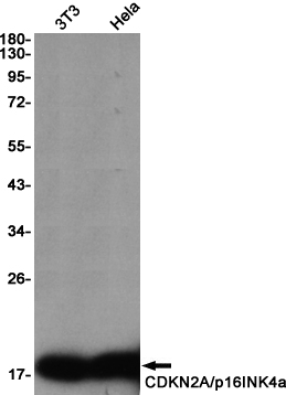 Western blot detection of CDKN2A-p16INK4a in 3T3,Hela cell lysates using CDKN2A/p16INK4a Rabbit pAb(1:1000 diluted).Predicted band size:17KDa.Observed band size:17KDa.