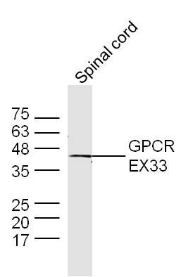 Fig7: Sample:; Spinal cord (Mouse) Lysate at 40 ug; Primary: Anti-GPCR EX33 at 1/300 dilution; Secondary: IRDye800CW Goat Anti-Rabbit IgG at 1/20000 dilution; Predicted band size: 44 kD; Observed band size: 44 kD