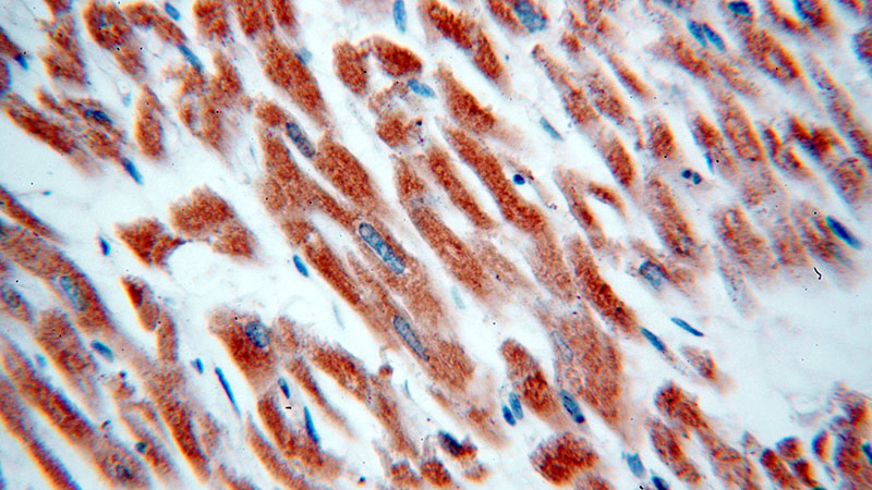 Immunohistochemical of paraffin-embedded human heart using Catalog No:111674(IFT88 antibody) at dilution of 1:50 (under 40x lens)