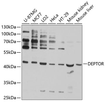 Western blot - DEPDC6 Polyclonal Antibody 