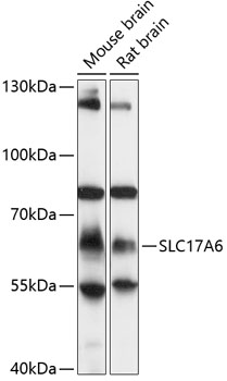 Western blot - SLC17A6 Polyclonal Antibody 