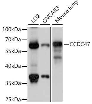 Western blot - CCDC47 Polyclonal Antibody 