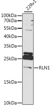 Western blot - RLN1 Polyclonal Antibody 