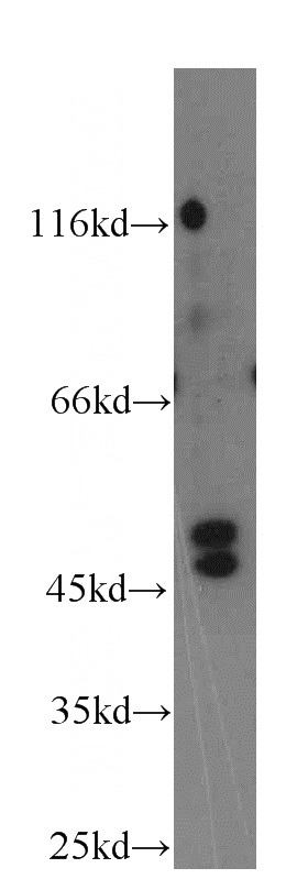 COLO 320 cells were subjected to SDS PAGE followed by western blot with Catalog No:116310(TRIM31 antibody) at dilution of 1:400
