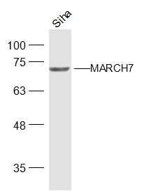 Fig2: Sample:; Siha(Human) Cell Lysate at 30 ug; Primary: Anti-MARCH7 at 1/500 dilution; Secondary: IRDye800CW Goat Anti-Rabbit IgG at 1/20000 dilution; Predicted band size: 78 kD; Observed band size: 73 kD