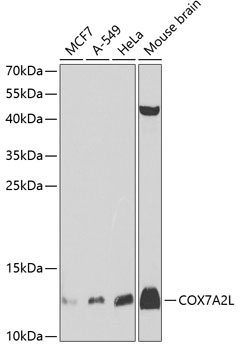 Western blot - COX7A2L Polyclonal Antibody 