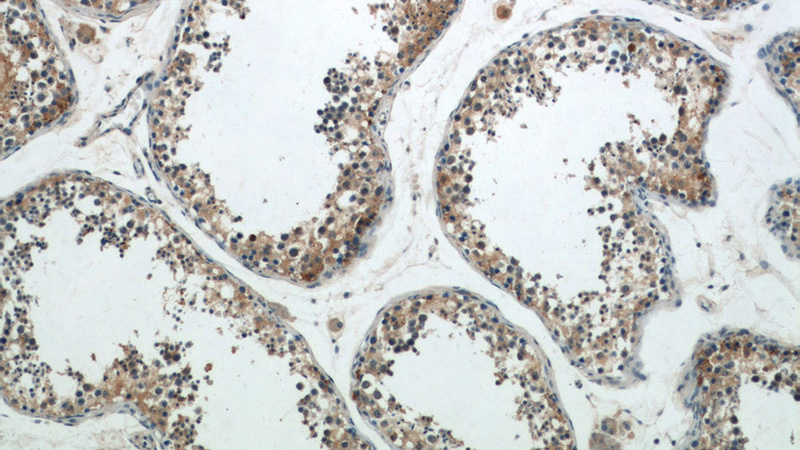 Immunohistochemical of paraffin-embedded human testis using Catalog No:115624(ST3GAL4 antibody) at dilution of 1:50 (under 10x lens)