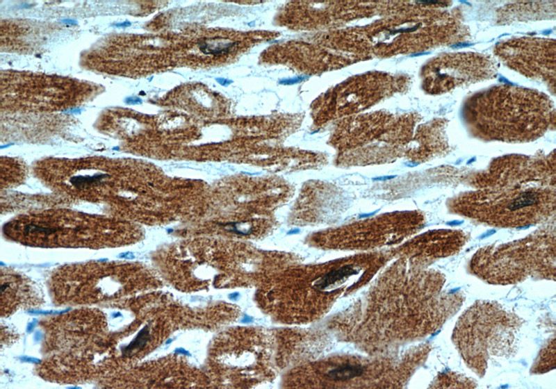Immunohistochemical of paraffin-embedded human heart using Catalog No:111700(HSP27 antibody) at dilution of 1:50 (under 40x lens)