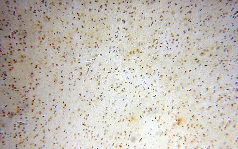 Immunohistochemical of paraffin-embedded human brain using Catalog No:111479(HMGB2 antibody) at dilution of 1:100 (under 10x lens)
