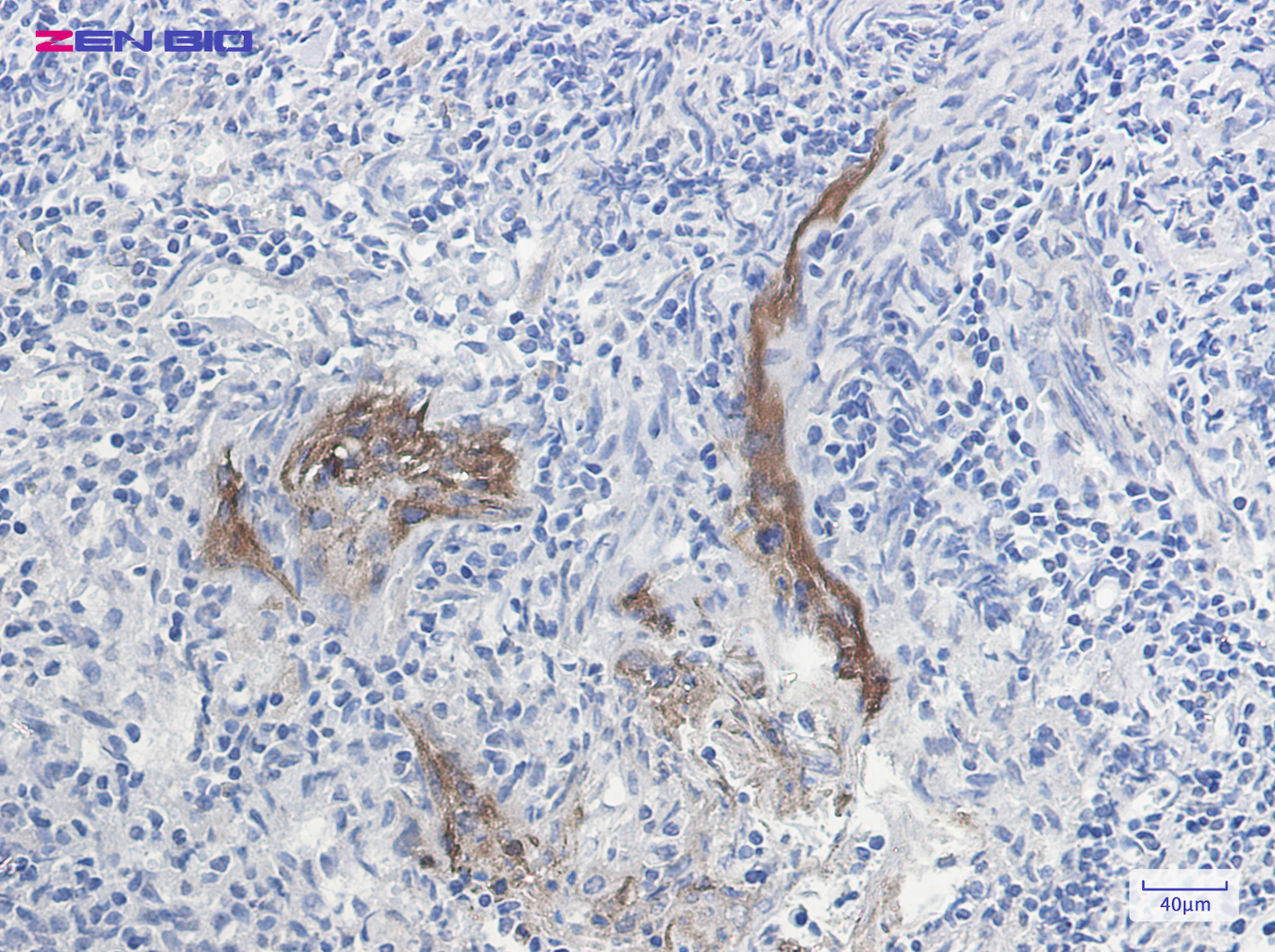 Immunohistochemistry of Extracellular matrix protein 1 in paraffin-embedded Human tonsil using Extracellular matrix protein 1 Rabbit pAb at dilution 1/20