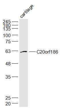 Fig1: Sample:; Cartilage (Mouse) Lysate at 40 ug; Primary: Anti-C20orf186 at 1/1000 dilution; Secondary: IRDye800CW Goat Anti-Rabbit IgG at 1/20000 dilution; Predicted band size: 63 kD; Observed band size: 62 kD