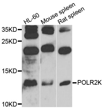 Western blot - POLR2K Polyclonal Antibody 