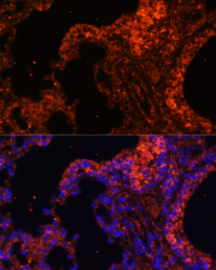 Immunofluorescence - SPTA1 Polyclonal Antibody 