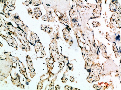 Fig1:; Immunohistochemical analysis of paraffin-embedded human-placenta, antibody was diluted at 1:200