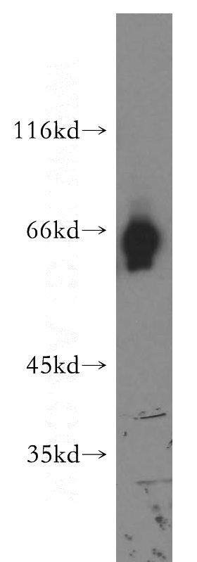 human brain tissue were subjected to SDS PAGE followed by western blot with Catalog No:108290(KIAA0652 antibody) at dilution of 1:500