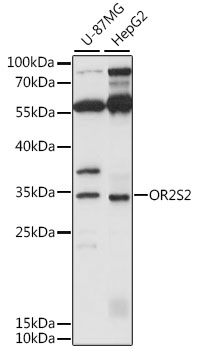 Western blot - OR2S2 Polyclonal Antibody 