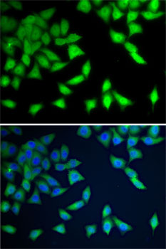 Immunofluorescence - WDR77 Polyclonal Antibody 