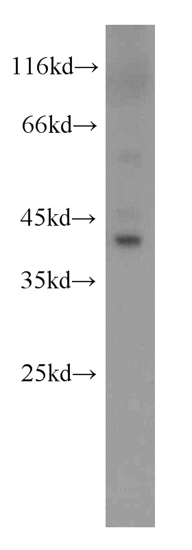 mouse liver tissue were subjected to SDS PAGE followed by western blot with Catalog No:107840(AGXT antibody) at dilution of 1:1000