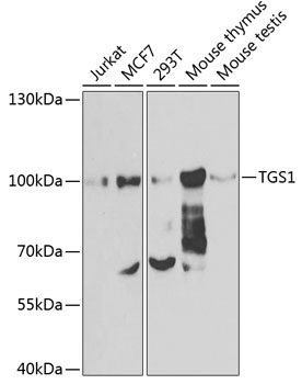 Western blot - TGS1 Polyclonal Antibody 