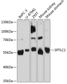 Western blot - SPTLC2 Polyclonal Antibody 
