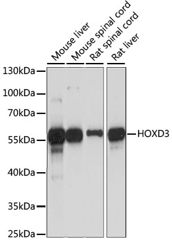 Western blot - HOXD3 Polyclonal Antibody 