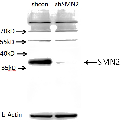 A549 cells (shcontrol and shRNA of SMN) were subjected to SDS PAGE followed by western blot with Catalog No:115393 (SMN2 antibody) at dilution of 1:1000. (Data provided by Angran Biotech (www.miRNAlab.com)).