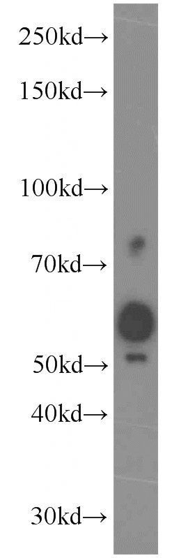 mouse testis tissue were subjected to SDS PAGE followed by western blot with Catalog No:115576(SPO11 antibody) at dilution of 1:400