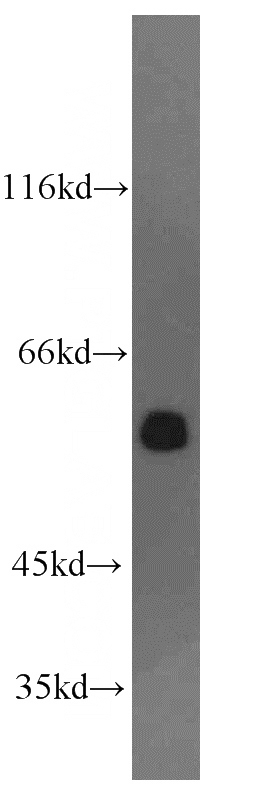 Jurkat cells were subjected to SDS PAGE followed by western blot with Catalog No:114514(RAD23B antibody) at dilution of 1:200