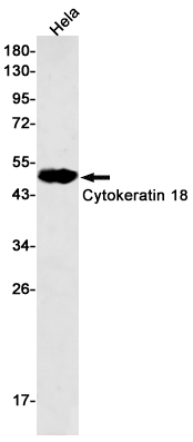 Western blot detection of Cytokeratin 18 in Hela cell lysates using Cytokeratin 18 Rabbit mAb(1:500 diluted).Predicted band size:48kDa.Observed band size:48kDa.