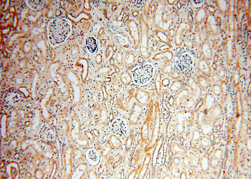 Immunohistochemical of paraffin-embedded human kidney using Catalog No:108262(ARHGAP18 antibody) at dilution of 1:25 (under 10x lens)