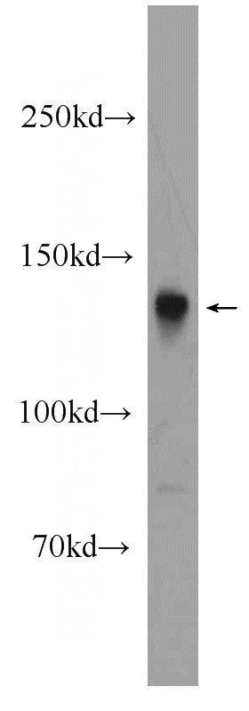 rat brain tissue were subjected to SDS PAGE followed by western blot with Catalog No:115813(STXBP5 Antibody) at dilution of 1:300