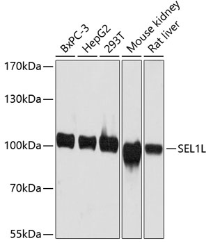 Western blot - SEL1L Polyclonal Antibody 