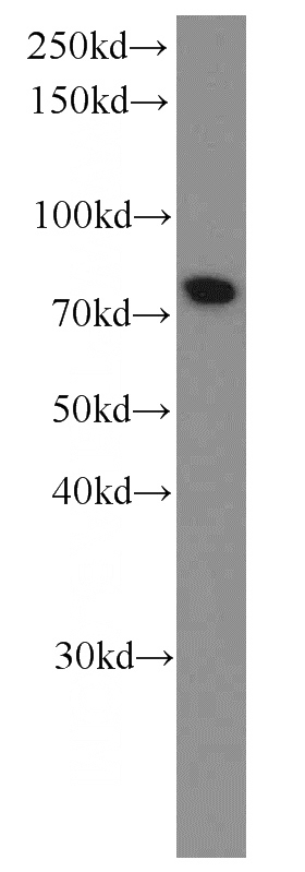 HEK-293 cells were subjected to SDS PAGE followed by western blot with Catalog No:107608(STIM1 Antibody) at dilution of 1:1000