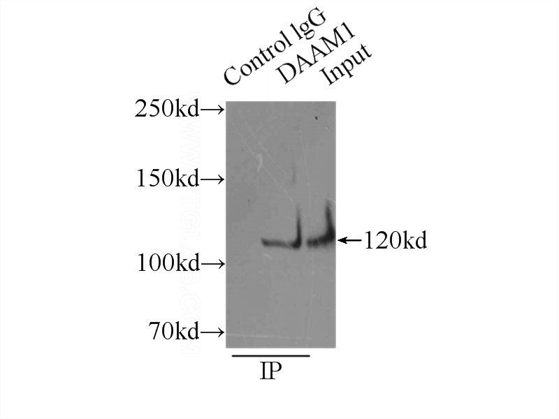 IP Result of anti-DAAM1 (IP:Catalog No:109818, 3ug; Detection:Catalog No:109818 1:500) with mouse liver tissue lysate 8000ug.