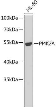 Western blot - PI4K2A Polyclonal Antibody 