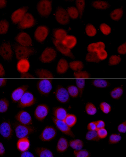 Immunofluorescence - BAZ1B Polyclonal Antibody 