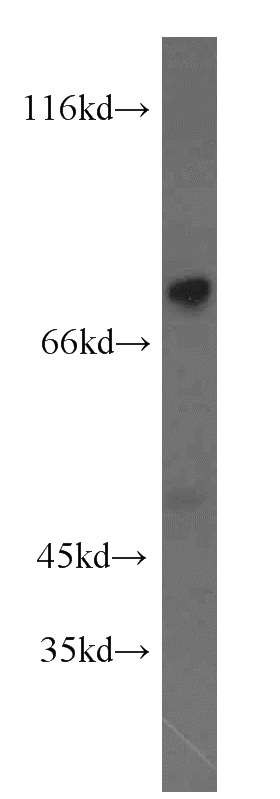 A431 cells were subjected to SDS PAGE followed by western blot with Catalog No:110627(FGD3 antibody) at dilution of 1:500