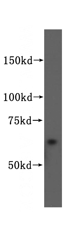 human heart tissue were subjected to SDS PAGE followed by western blot with Catalog No:113914(PIP5K1A antibody) at dilution of 1:500