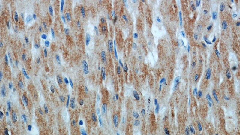 Immunohistochemical of paraffin-embedded human heart using Catalog No:116667(UBXN4 antibody) at dilution of 1:100 (under 40x lens)