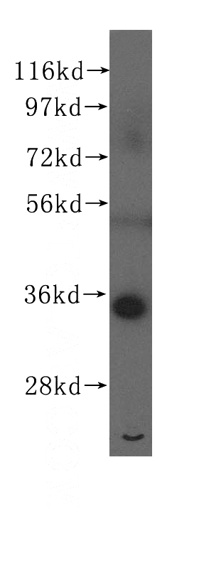 HeLa cells were subjected to SDS PAGE followed by western blot with Catalog No:114905(RPLP0 antibody) at dilution of 1:300