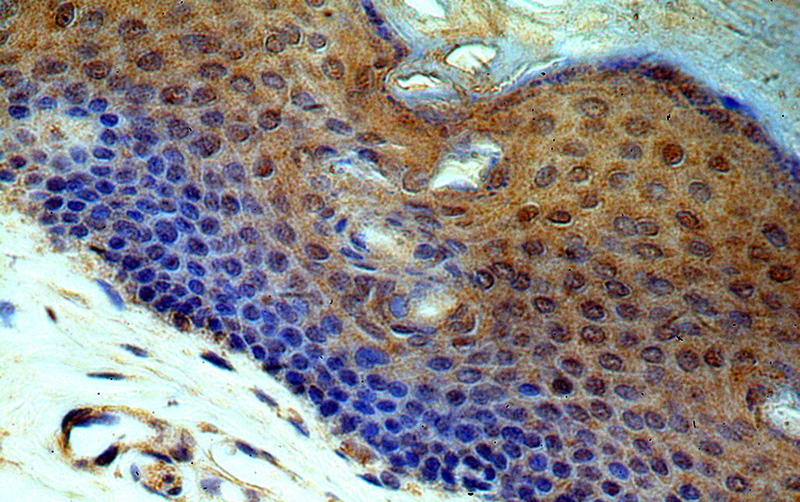 Immunohistochemical of paraffin-embedded human skin using Catalog No:116421(TRUB2 antibody) at dilution of 1:50 (under 40x lens)