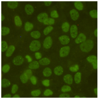 Immunocytochemistry staining of HeLa cells fixed with 1% Paraformaldehyde and using anti-ERM/Etv5 mouse mAb (dilution 1:500).