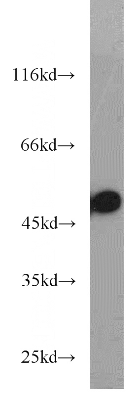 A549 cells were subjected to SDS PAGE followed by western blot with Catalog No:116020(TGFB2-Specific antibody) at dilution of 1:600